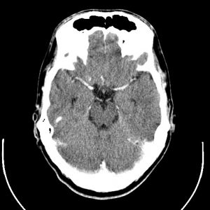 examen resonancia magnetica tac de cerebro 2